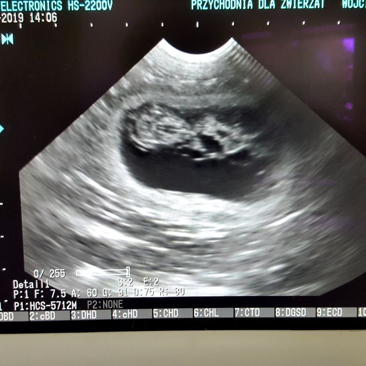 Zdjęcie USG potwierdzające ciążę